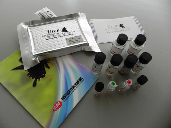 Белок плотных контактов 1 (TJP1, Белок Zonula occludens 1 (ZO-1)) (не для использования в медицинских целях)